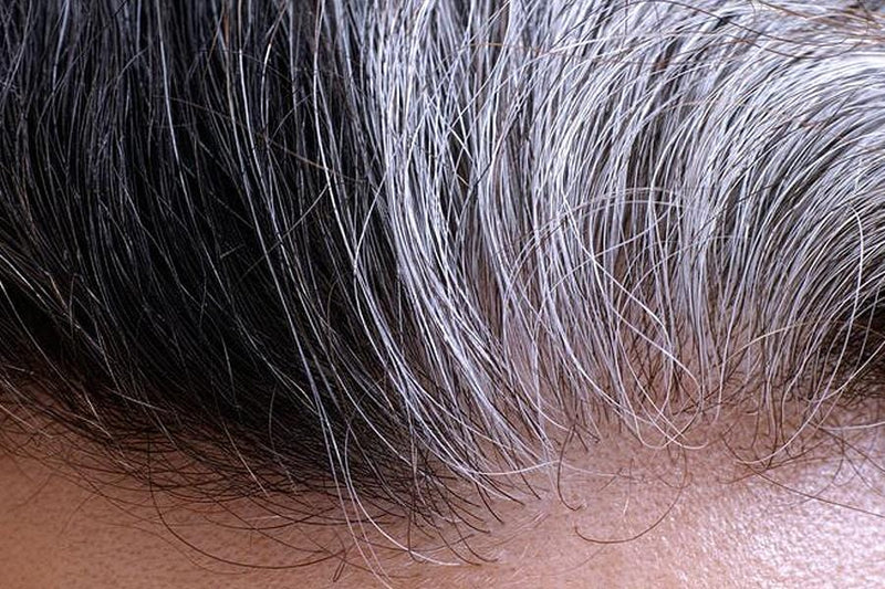 Evita la aparición de canas con estos sencillos remedios